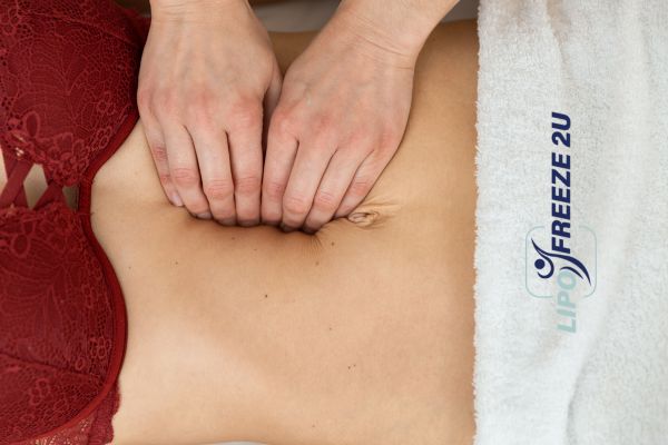 diastasis recti treatment Milton Keynes
