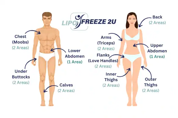 Areas you can have fat freezing treatment Milton Keynes