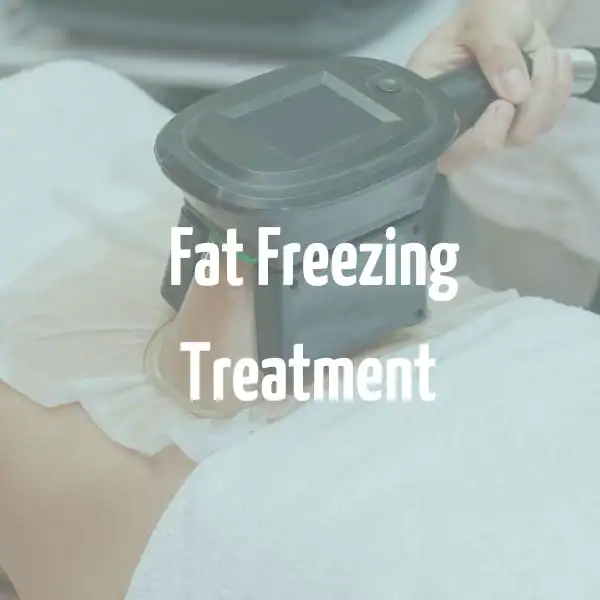 fat freezing treatment Milton Keynes