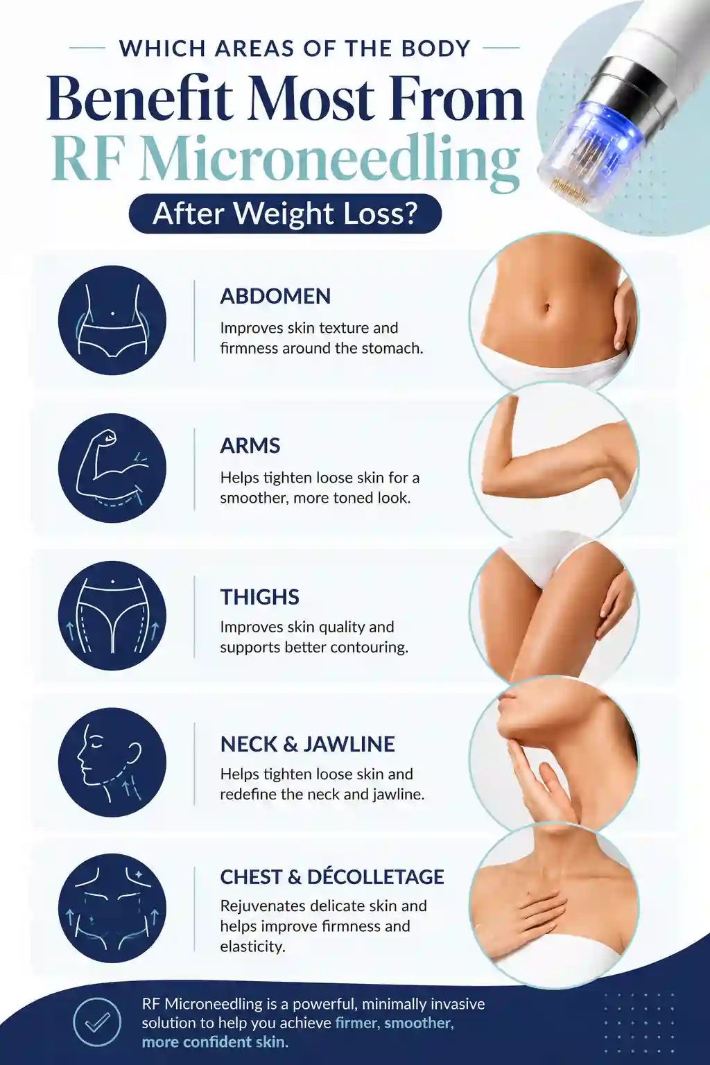 Which Areas of the Body Benefit Most From RF Microneedling After Weight Loss Milton Keynes